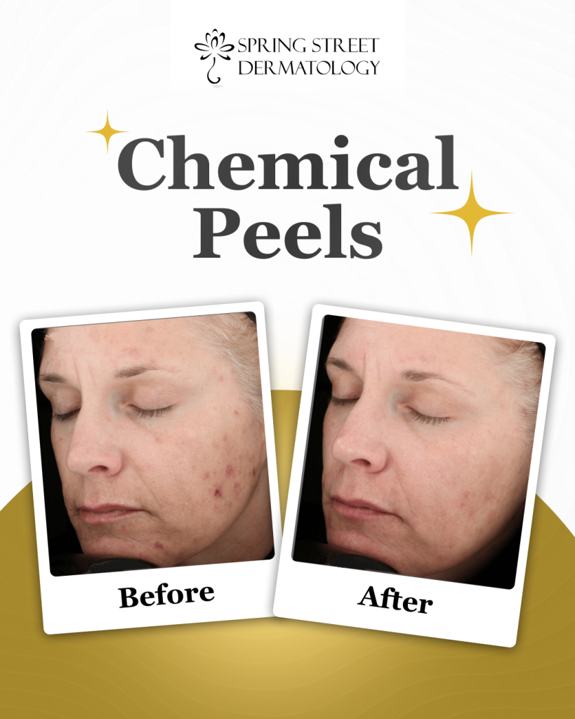 Spring Street Dermatology social media post